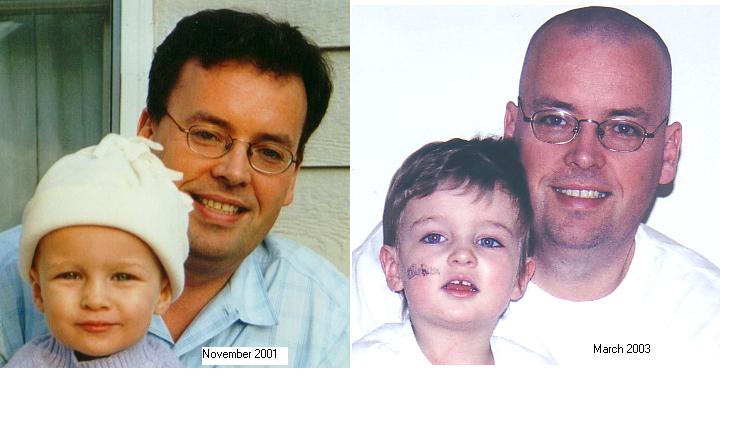Before & After